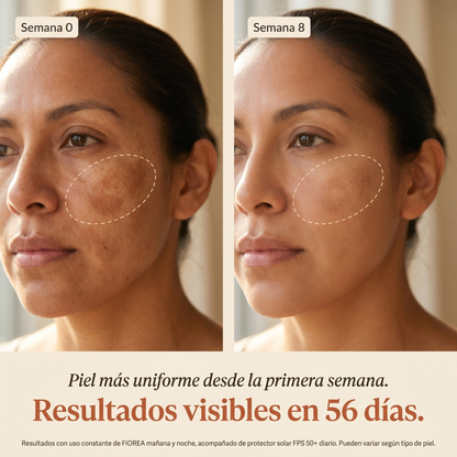 Fiorea® Crema TXN - Adiós Manchas