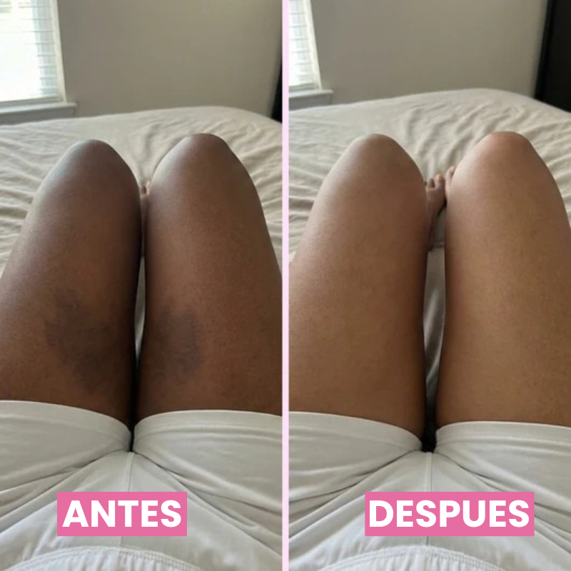 Serum Corporal Iluminador