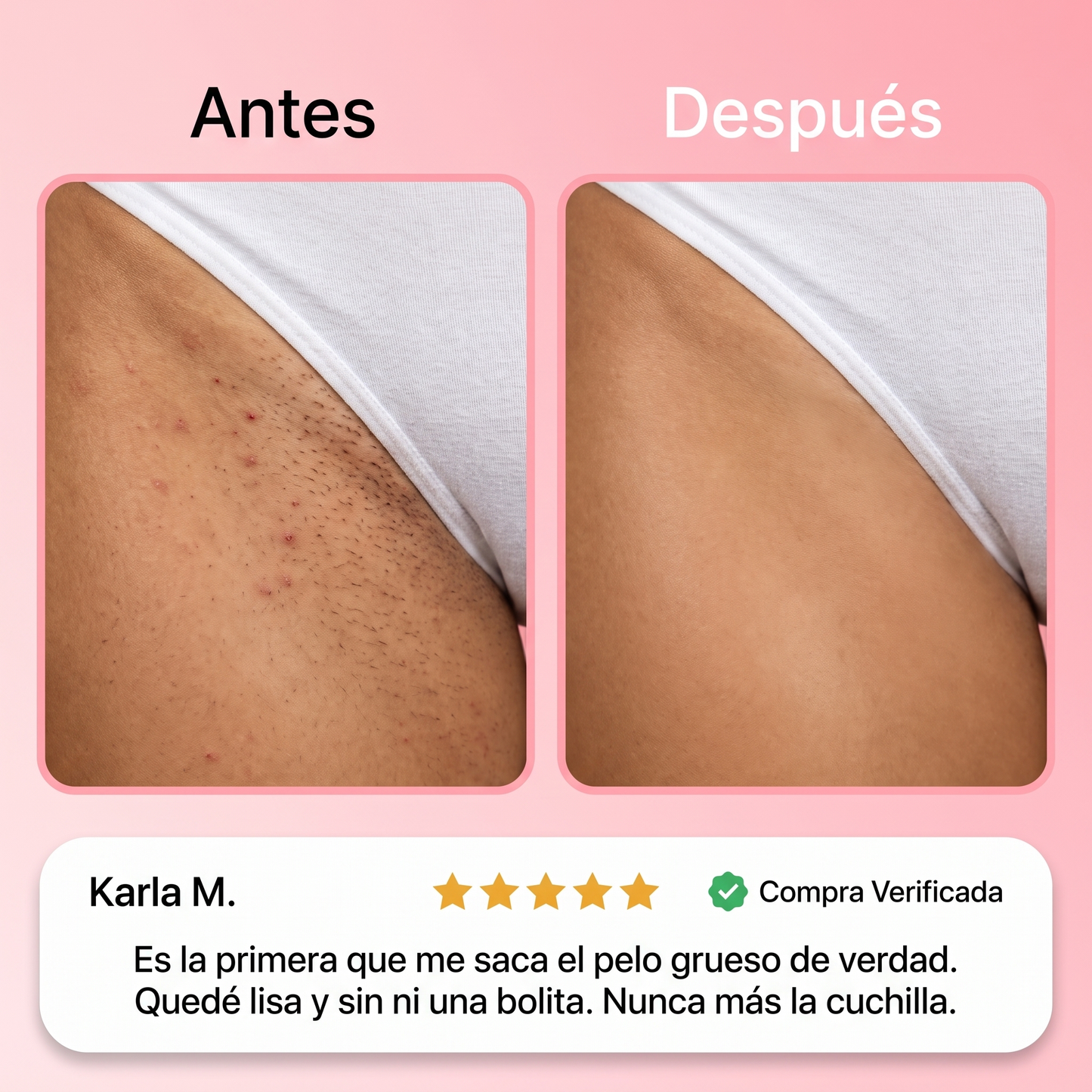 Crema Depilatoria Indolora